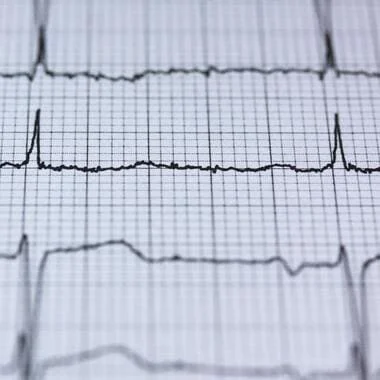Quelle fréquence cardiaque pour avoir la santé ?